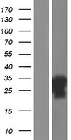 Western blot validation of overexpression lysate (Cat# LY427895) using anti-DDK antibody (Cat# TA50011-100). Left: Cell lysates from un-transfected HEK293T cells; Right: Cell lysates from HEK293T cells transfected with RC227251 using transfection reagent MegaTran 2.0 (Cat# TT210002).