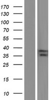 Western blot validation of overexpression lysate (Cat# LY421763) using anti-DDK antibody (Cat# TA50011-100). Left: Cell lysates from un-transfected HEK293T cells; Right: Cell lysates from HEK293T cells transfected with RC202616 using transfection reagent MegaTran 2.0 (Cat# TT210002).