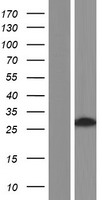 Western blot validation of overexpression lysate (Cat# LY404647) using anti-DDK antibody (Cat# TA50011-100). Left: Cell lysates from un-transfected HEK293T cells; Right: Cell lysates from HEK293T cells transfected with RC218773 using transfection reagent MegaTran 2.0 (Cat# TT210002).