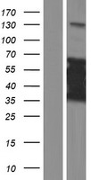 Western blot validation of overexpression lysate (Cat# LY421595) using anti-DDK antibody (Cat# TA50011-100). Left: Cell lysates from un-transfected HEK293T cells; Right: Cell lysates from HEK293T cells transfected with RC219281 using transfection reagent MegaTran 2.0 (Cat# TT210002).