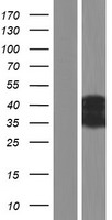 Western blot validation of overexpression lysate (Cat# LY421597) using anti-DDK antibody (Cat# TA50011-100). Left: Cell lysates from un-transfected HEK293T cells; Right: Cell lysates from HEK293T cells transfected with RC223845 using transfection reagent MegaTran 2.0 (Cat# TT210002).