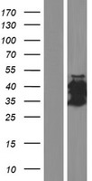 Western blot validation of overexpression lysate (Cat# LY421600) using anti-DDK antibody (Cat# TA50011-100). Left: Cell lysates from un-transfected HEK293T cells; Right: Cell lysates from HEK293T cells transfected with RC214103 using transfection reagent MegaTran 2.0 (Cat# TT210002).