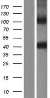 Western blot validation of overexpression lysate (Cat# LY431864) using anti-DDK antibody (Cat# TA50011-100). Left: Cell lysates from un-transfected HEK293T cells; Right: Cell lysates from HEK293T cells transfected with RC228836 using transfection reagent MegaTran 2.0 (Cat# TT210002).