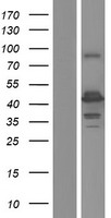Western blot validation of overexpression lysate (Cat# LY432946) using anti-DDK antibody (Cat# TA50011-100). Left: Cell lysates from un-transfected HEK293T cells; Right: Cell lysates from HEK293T cells transfected with RC229946 using transfection reagent MegaTran 2.0 (Cat# TT210002).