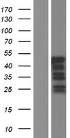Western blot validation of overexpression lysate (Cat# LY413402) using anti-DDK antibody (Cat# TA50011-100). Left: Cell lysates from un-transfected HEK293T cells; Right: Cell lysates from HEK293T cells transfected with RC219699 using transfection reagent MegaTran 2.0 (Cat# TT210002).