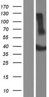 Western blot validation of overexpression lysate (Cat# LY408678) using anti-DDK antibody (Cat# TA50011-100). Left: Cell lysates from un-transfected HEK293T cells; Right: Cell lysates from HEK293T cells transfected with RC204271 using transfection reagent MegaTran 2.0 (Cat# TT210002).