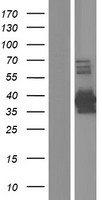 Western blot validation of overexpression lysate (Cat# LY427177) using anti-DDK antibody (Cat# TA50011-100). Left: Cell lysates from un-transfected HEK293T cells; Right: Cell lysates from HEK293T cells transfected with RC225516 using transfection reagent MegaTran 2.0 (Cat# TT210002).