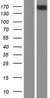 Western blot validation of overexpression lysate (Cat# LY434484) using anti-DDK antibody (Cat# TA50011-100). Left: Cell lysates from un-transfected HEK293T cells; Right: Cell lysates from HEK293T cells transfected with RC231486 using transfection reagent MegaTran 2.0 (Cat# TT210002).