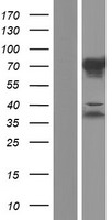 Western blot validation of overexpression lysate (Cat# LY421254) using anti-DDK antibody (Cat# TA50011-100). Left: Cell lysates from un-transfected HEK293T cells; Right: Cell lysates from HEK293T cells transfected with RC214312 using transfection reagent MegaTran 2.0 (Cat# TT210002).
