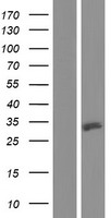 Western blot validation of overexpression lysate (Cat# LY411262) using anti-DDK antibody (Cat# TA50011-100). Left: Cell lysates from un-transfected HEK293T cells; Right: Cell lysates from HEK293T cells transfected with RC219672 using transfection reagent MegaTran 2.0 (Cat# TT210002).