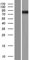 Western blot validation of overexpression lysate (Cat# LY404212) using anti-DDK antibody (Cat# TA50011-100). Left: Cell lysates from un-transfected HEK293T cells; Right: Cell lysates from HEK293T cells transfected with RC212714 using transfection reagent MegaTran 2.0 (Cat# TT210002).