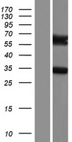 Western blot validation of overexpression lysate (Cat# LY421603) using anti-DDK antibody (Cat# TA50011-100). Left: Cell lysates from un-transfected HEK293T cells; Right: Cell lysates from HEK293T cells transfected with RC222813 using transfection reagent MegaTran 2.0 (Cat# TT210002).