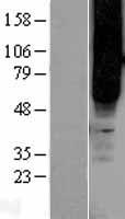Western blot validation of overexpression lysate (Cat# LY401635) using anti-DDK antibody (Cat# TA50011-100). Left: Cell lysates from un-transfected HEK293T cells; Right: Cell lysates from HEK293T cells transfected with RC217983 using transfection reagent MegaTran 2.0 (Cat# TT210002).