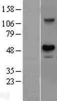 Western blot validation of overexpression lysate (Cat# LY403555) using anti-DDK antibody (Cat# TA50011-100). Left: Cell lysates from un-transfected HEK293T cells; Right: Cell lysates from HEK293T cells transfected with RC218255 using transfection reagent MegaTran 2.0 (Cat# TT210002).