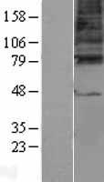 Western blot validation of overexpression lysate (Cat# LY403235) using anti-DDK antibody (Cat# TA50011-100). Left: Cell lysates from un-transfected HEK293T cells; Right: Cell lysates from HEK293T cells transfected with RC221044 using transfection reagent MegaTran 2.0 (Cat# TT210002).
