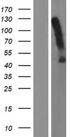 Western blot validation of overexpression lysate (Cat# LY402766) using anti-DDK antibody (Cat# TA50011-100). Left: Cell lysates from un-transfected HEK293T cells; Right: Cell lysates from HEK293T cells transfected with RC206092 using transfection reagent MegaTran 2.0 (Cat# TT210002).