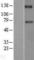 Western blot validation of overexpression lysate (Cat# LY400043) using anti-DDK antibody (Cat# TA50011-100). Left: Cell lysates from un-transfected HEK293T cells; Right: Cell lysates from HEK293T cells transfected with RC213056 using transfection reagent MegaTran 2.0 (Cat# TT210002).