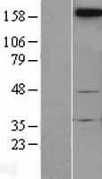 Western blot validation of overexpression lysate (Cat# LY400890) using anti-DDK antibody (Cat# TA50011-100). Left: Cell lysates from un-transfected HEK293T cells; Right: Cell lysates from HEK293T cells transfected with RC216942 using transfection reagent MegaTran 2.0 (Cat# TT210002).