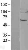 Western blot validation of overexpression lysate (Cat# LY402751) using anti-DDK antibody (Cat# TA50011-100). Left: Cell lysates from un-transfected HEK293T cells; Right: Cell lysates from HEK293T cells transfected with RC209514 using transfection reagent MegaTran 2.0 (Cat# TT210002).