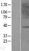 Western blot validation of overexpression lysate (Cat# LY401394) using anti-DDK antibody (Cat# TA50011-100). Left: Cell lysates from un-transfected HEK293T cells; Right: Cell lysates from HEK293T cells transfected with RC217036 using transfection reagent MegaTran 2.0 (Cat# TT210002).