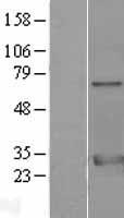 Western blot validation of overexpression lysate (Cat# LY427676) using anti-DDK antibody (Cat# TA50011-100). Left: Cell lysates from un-transfected HEK293T cells; Right: Cell lysates from HEK293T cells transfected with RC227049 using transfection reagent MegaTran 2.0 (Cat# TT210002).