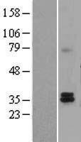 Western blot validation of overexpression lysate (Cat# LY400038) using anti-DDK antibody (Cat# TA50011-100). Left: Cell lysates from un-transfected HEK293T cells; Right: Cell lysates from HEK293T cells transfected with RC218841 using transfection reagent MegaTran 2.0 (Cat# TT210002).