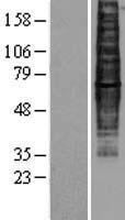 Western blot validation of overexpression lysate (Cat# LY401987) using anti-DDK antibody (Cat# TA50011-100). Left: Cell lysates from un-transfected HEK293T cells; Right: Cell lysates from HEK293T cells transfected with RC210246 using transfection reagent MegaTran 2.0 (Cat# TT210002).