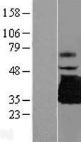Western blot validation of overexpression lysate (Cat# LY406014) using anti-DDK antibody (Cat# TA50011-100). Left: Cell lysates from un-transfected HEK293T cells; Right: Cell lysates from HEK293T cells transfected with RC219476 using transfection reagent MegaTran 2.0 (Cat# TT210002).
