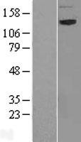 Western blot validation of overexpression lysate (Cat# LY414312) using anti-DDK antibody (Cat# TA50011-100). Left: Cell lysates from un-transfected HEK293T cells; Right: Cell lysates from HEK293T cells transfected with RC224157 using transfection reagent MegaTran 2.0 (Cat# TT210002).