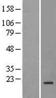 Western blot validation of overexpression lysate (Cat# LY407584) using anti-DDK antibody (Cat# TA50011-100). Left: Cell lysates from un-transfected HEK293T cells; Right: Cell lysates from HEK293T cells transfected with RC214816 using transfection reagent MegaTran 2.0 (Cat# TT210002).