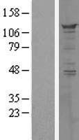 Western blot validation of overexpression lysate (Cat# LY418540) using anti-DDK antibody (Cat# TA50011-100). Left: Cell lysates from un-transfected HEK293T cells; Right: Cell lysates from HEK293T cells transfected with RC220285 using transfection reagent MegaTran 2.0 (Cat# TT210002).