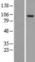 Western blot validation of overexpression lysate (Cat# LY407882) using anti-DDK antibody (Cat# TA50011-100). Left: Cell lysates from un-transfected HEK293T cells; Right: Cell lysates from HEK293T cells transfected with RC209112 using transfection reagent MegaTran 2.0 (Cat# TT210002).