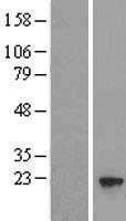 Western blot validation of overexpression lysate (Cat# LY414002) using anti-DDK antibody (Cat# TA50011-100). Left: Cell lysates from un-transfected HEK293T cells; Right: Cell lysates from HEK293T cells transfected with RC202661 using transfection reagent MegaTran 2.0 (Cat# TT210002).