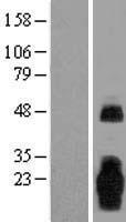 Western blot validation of overexpression lysate (Cat# LY405925) using anti-DDK antibody (Cat# TA50011-100). Left: Cell lysates from un-transfected HEK293T cells; Right: Cell lysates from HEK293T cells transfected with RC207968 using transfection reagent MegaTran 2.0 (Cat# TT210002).