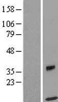 Western blot validation of overexpression lysate (Cat# LY409981) using anti-DDK antibody (Cat# TA50011-100). Left: Cell lysates from un-transfected HEK293T cells; Right: Cell lysates from HEK293T cells transfected with RC202584 using transfection reagent MegaTran 2.0 (Cat# TT210002).