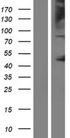 Western blot validation of overexpression lysate (Cat# LY424826) using anti-DDK antibody (Cat# TA50011-100). Left: Cell lysates from un-transfected HEK293T cells; Right: Cell lysates from HEK293T cells transfected with RC211455 using transfection reagent MegaTran 2.0 (Cat# TT210002).