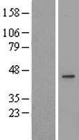 Western blot validation of overexpression lysate (Cat# LY413157) using anti-DDK antibody (Cat# TA50011-100). Left: Cell lysates from un-transfected HEK293T cells; Right: Cell lysates from HEK293T cells transfected with RC215907 using transfection reagent MegaTran 2.0 (Cat# TT210002).
