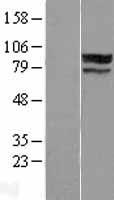 Western blot validation of overexpression lysate (Cat# LY404867) using anti-DDK antibody (Cat# TA50011-100). Left: Cell lysates from un-transfected HEK293T cells; Right: Cell lysates from HEK293T cells transfected with RC218609 using transfection reagent MegaTran 2.0 (Cat# TT210002).