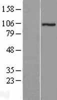 Western blot validation of overexpression lysate (Cat# LY414483) using anti-DDK antibody (Cat# TA50011-100). Left: Cell lysates from un-transfected HEK293T cells; Right: Cell lysates from HEK293T cells transfected with RC207828 using transfection reagent MegaTran 2.0 (Cat# TT210002).