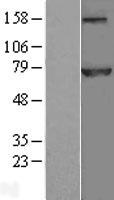 Western blot validation of overexpression lysate (Cat# LY418359) using anti-DDK antibody (Cat# TA50011-100). Left: Cell lysates from un-transfected HEK293T cells; Right: Cell lysates from HEK293T cells transfected with RC205639 using transfection reagent MegaTran 2.0 (Cat# TT210002).