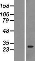 Western blot validation of overexpression lysate (Cat# LY420646) using anti-DDK antibody (Cat# TA50011-100). Left: Cell lysates from un-transfected HEK293T cells; Right: Cell lysates from HEK293T cells transfected with RC221867 using transfection reagent MegaTran 2.0 (Cat# TT210002).