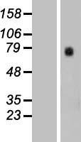 Western blot validation of overexpression lysate (Cat# LY415798) using anti-DDK antibody (Cat# TA50011-100). Left: Cell lysates from un-transfected HEK293T cells; Right: Cell lysates from HEK293T cells transfected with RC207903 using transfection reagent MegaTran 2.0 (Cat# TT210002).
