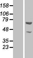 Western blot validation of overexpression lysate (Cat# LY410026) using anti-DDK antibody (Cat# TA50011-100). Left: Cell lysates from un-transfected HEK293T cells; Right: Cell lysates from HEK293T cells transfected with RC206091 using transfection reagent MegaTran 2.0 (Cat# TT210002).