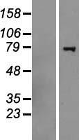 Western blot validation of overexpression lysate (Cat# LY413458) using anti-DDK antibody (Cat# TA50011-100). Left: Cell lysates from un-transfected HEK293T cells; Right: Cell lysates from HEK293T cells transfected with RC218907 using transfection reagent MegaTran 2.0 (Cat# TT210002).
