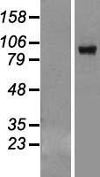 Western blot validation of overexpression lysate (Cat# LY414675) using anti-DDK antibody (Cat# TA50011-100). Left: Cell lysates from un-transfected HEK293T cells; Right: Cell lysates from HEK293T cells transfected with RC209854 using transfection reagent MegaTran 2.0 (Cat# TT210002).