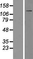 Western blot validation of overexpression lysate (Cat# LY415831) using anti-DDK antibody (Cat# TA50011-100). Left: Cell lysates from un-transfected HEK293T cells; Right: Cell lysates from HEK293T cells transfected with RC207069 using transfection reagent MegaTran 2.0 (Cat# TT210002).