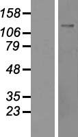 Western blot validation of overexpression lysate (Cat# LY415543) using anti-DDK antibody (Cat# TA50011-100). Left: Cell lysates from un-transfected HEK293T cells; Right: Cell lysates from HEK293T cells transfected with RC201046 using transfection reagent MegaTran 2.0 (Cat# TT210002).