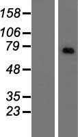 Western blot validation of overexpression lysate (Cat# LY415669) using anti-DDK antibody (Cat# TA50011-100). Left: Cell lysates from un-transfected HEK293T cells; Right: Cell lysates from HEK293T cells transfected with RC217418 using transfection reagent MegaTran 2.0 (Cat# TT210002).