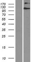 Western blot validation of overexpression lysate (Cat# LY406938) using anti-DDK antibody (Cat# TA50011-100). Left: Cell lysates from un-transfected HEK293T cells; Right: Cell lysates from HEK293T cells transfected with RC224382 using transfection reagent MegaTran 2.0 (Cat# TT210002).