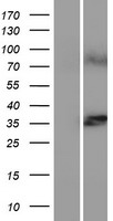 Western blot validation of overexpression lysate (Cat# LY404979) using anti-DDK antibody (Cat# TA50011-100). Left: Cell lysates from un-transfected HEK293T cells; Right: Cell lysates from HEK293T cells transfected with RC205167 using transfection reagent MegaTran 2.0 (Cat# TT210002).